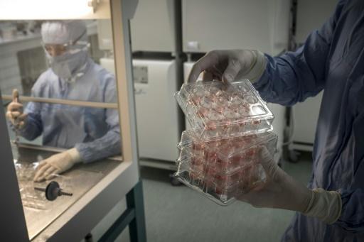 Cultivos de células para producir tejido humano se observan en el laboratorio de Episkin, en Lyon