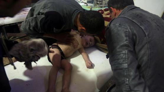 Enfermeros atienden a niño en Duma