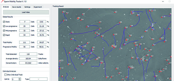 El "Sperm Motility Tracker" es un software de acceso libre