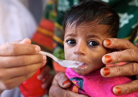 Un gran número de niños mal alimentados, alerta de Unicef. (foto: ANSA)