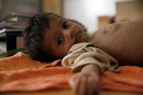 Unos 415 millones de niños en riesgo en el mundo (foto: EPA)