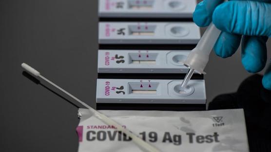 Los test de antígenos entregan el resultado en 15 minutos